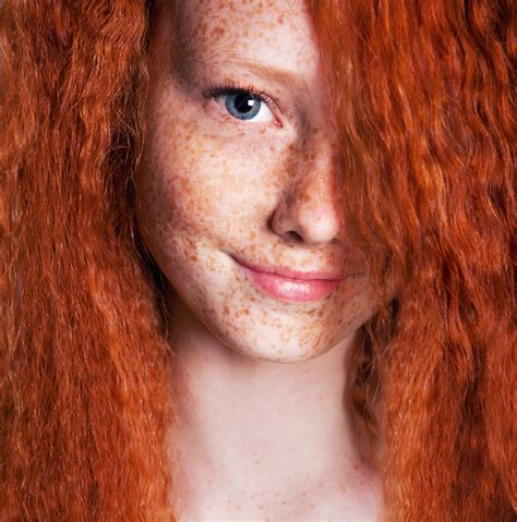 curly hair with freckles|inherited freckles on face.